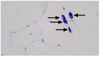 Key figure from Single cell RNA-sequencing suggests a novel lipid associated mast cell population following weight cycling 