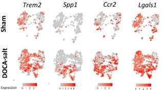 Key figure from Immune profiling of murine cardiac leukocytes identifies triggering receptor expressed on myeloid cells 2 as a novel mediator of hypertensive heart failure 